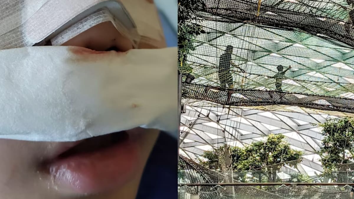 BCA, Jewel gesa pengunjung patuh peraturan keselamatan selepas kanak-kanak patah tulang hidung - BERITA Mediacorp
