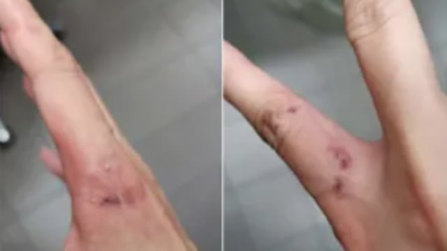 过境逗留时大闹火锅店还咬伤辅警 中国女子被判监提上诉