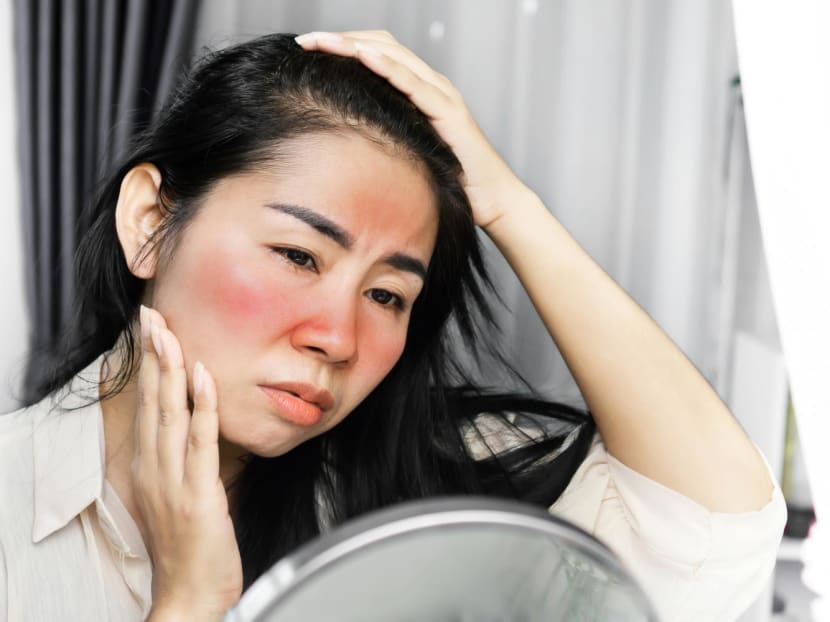 Do you get itchy, swollen, red rashes when you&rsquo;re outside? You may have a case of 'sun allergy'