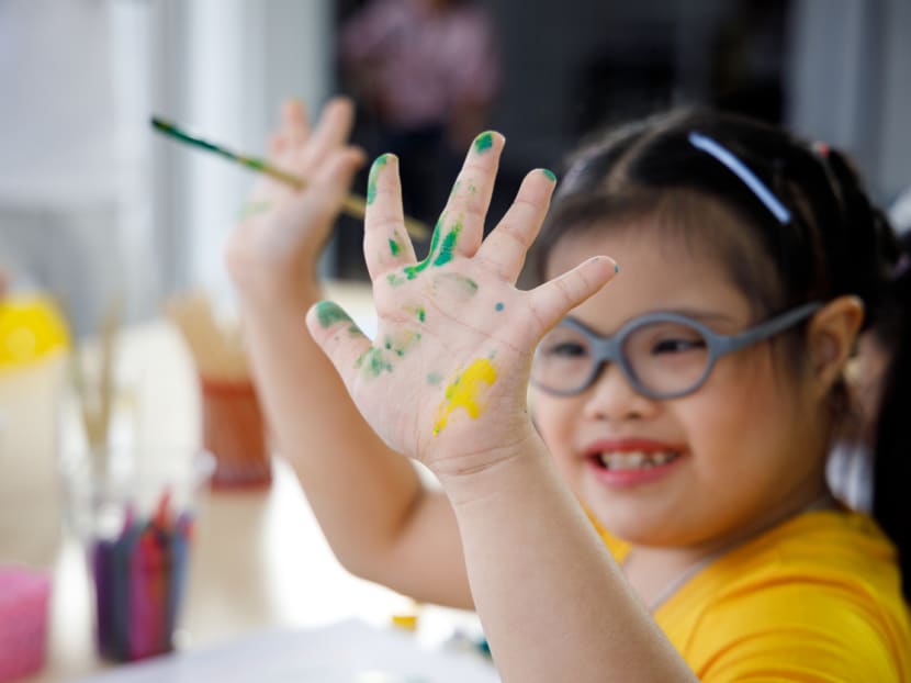 Opening our eyes to Down syndrome and how others live with disability Opening our eyes to Down syndrome and how others live with disability
