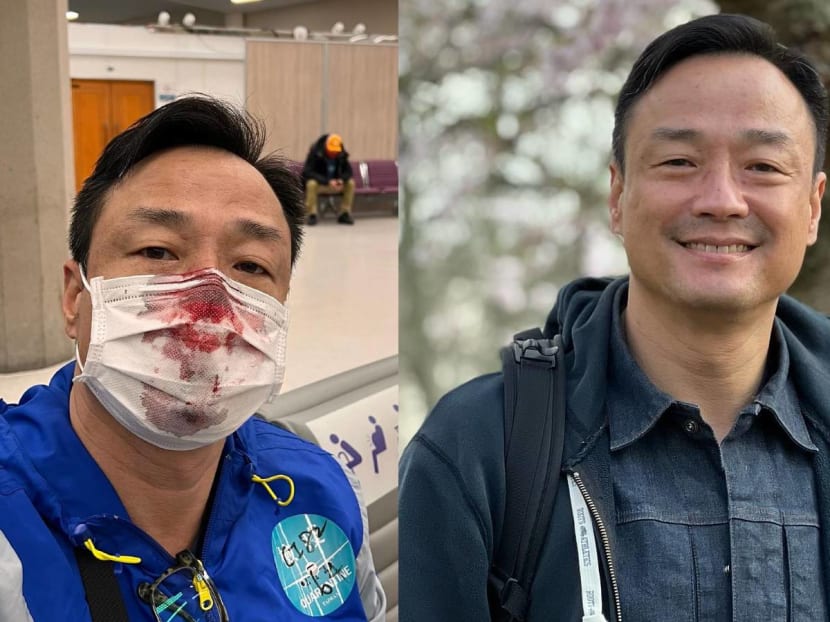 HK Actor Wong Hei Suffers Horrifying Nosebleed After Getting “Stabbed” In The Nose By Staff Administering His PCR Test At Taiwan Airport