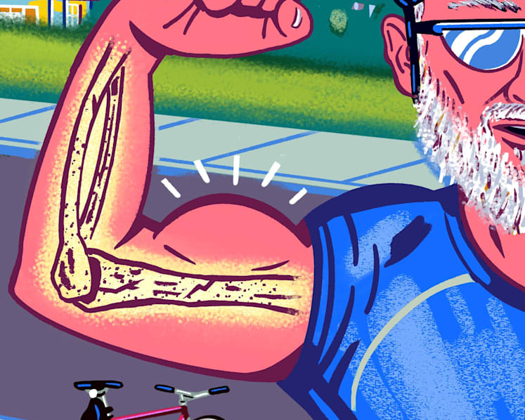 Osteoporosis in men? Why brittle bones aren’t just a woman’s problem