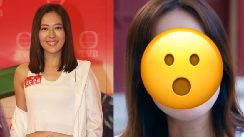 Netizens Say Natalie Tong, 41, Has “Unnatural-Looking Eyelids” In New Drama