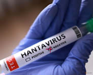 Tests in Italy, Spain come back negative in global hunt for hantavirus