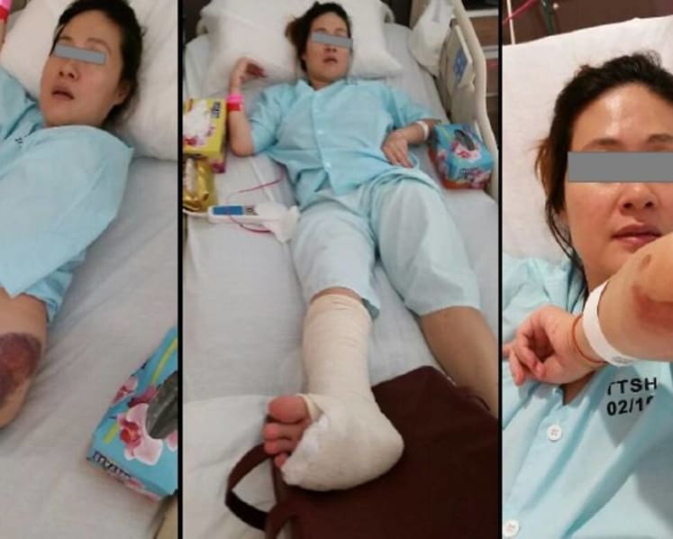 Woman who sued PUB for S$5 million after falling into manhole accepts settlement offer