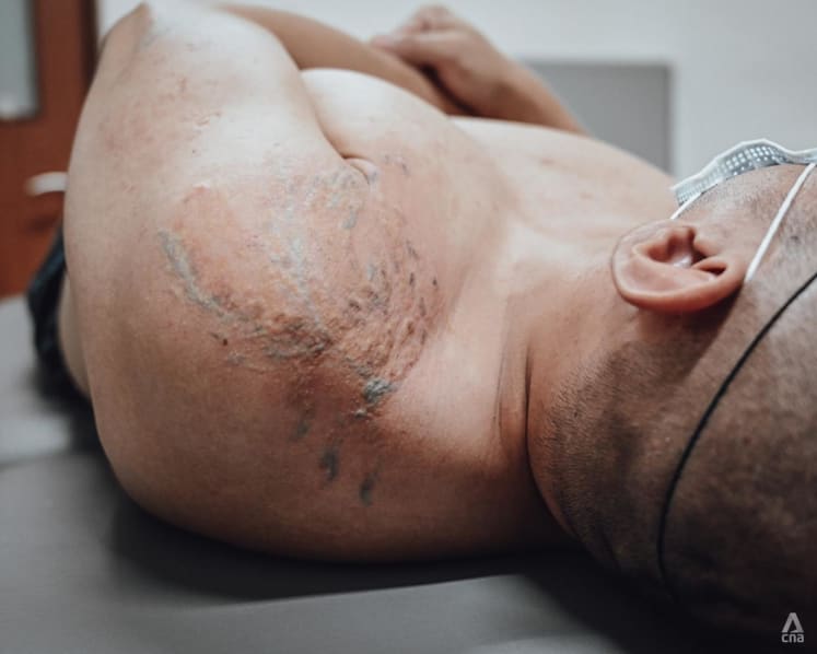'I feel very fresh': The former gangsters in prison getting their tattoos removed for free