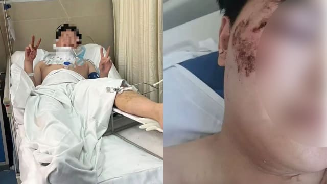 梦游从三楼坠落 中国男子：醒来就在空中