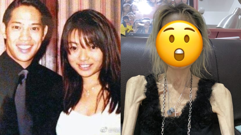 This HK Model, Whose Department Store Empire Heir Husband Left Her After She Got Sick, Weighed Only 22kg At The Peak Of Her Illness