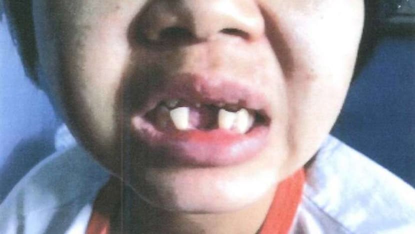 Jail for woman who hammered out maid’s teeth in 'worst' recent case of abuse Jail for woman who hammered out maid’s teeth in 'worst' recent case of abuse