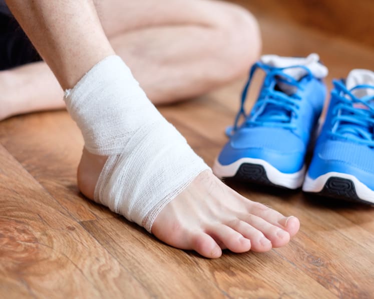 Like to jog or wear heels? Here’s why you should take sprained ankles seriously