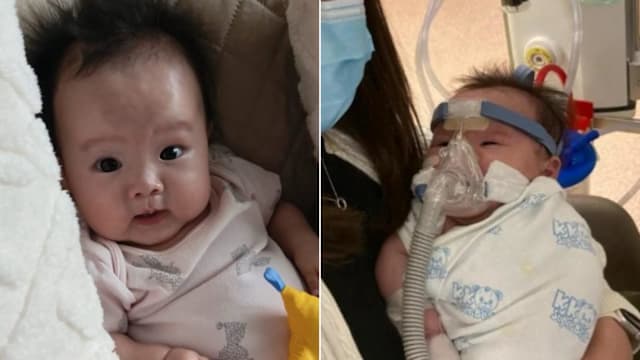 五个月大女婴患罕见疾病 父母冀众筹240万元药费