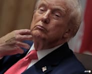 White House blames Trump's bandaged hand on handshakes