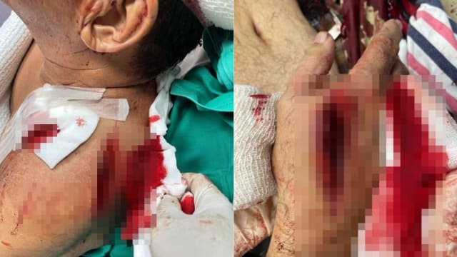 两贼深夜入屋行窃 马国阿叔反抗遭砍五刀皮开肉绽