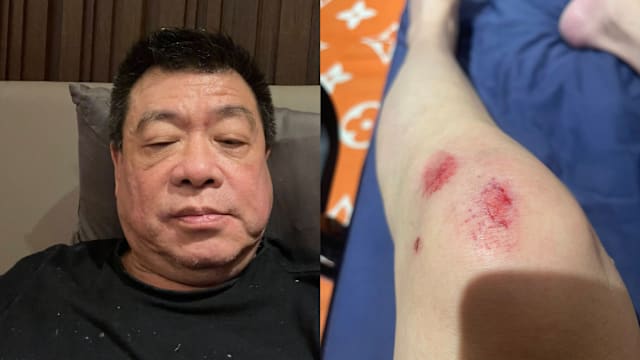 孙德荣独居在家重摔！无奈求助：可能就到西天了