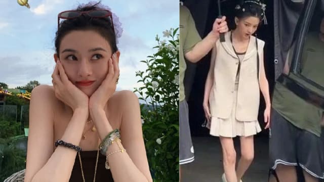 宋祖儿瘦成“排骨胸、竹竿腿”，粉丝超心疼！