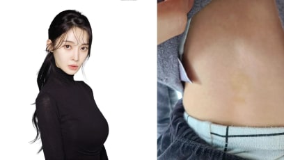 t-ara_areum_abuse_1
