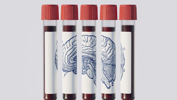 channelnewsasia.com - CNA Lifestyle - Could a blood test predict if you'll get Alzheimer's years before symptoms appear?