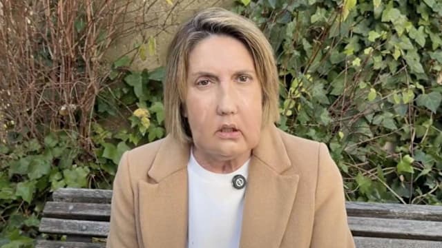 安乐死患者捐脸移植创全球首例 受捐者照镜重见自己