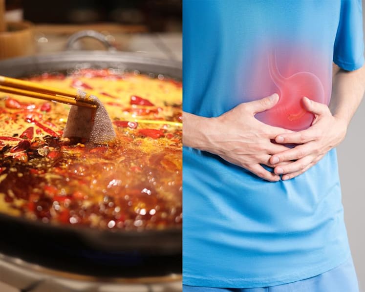 Can stress really cause stomach ulcers? What about spicy food and coffee?