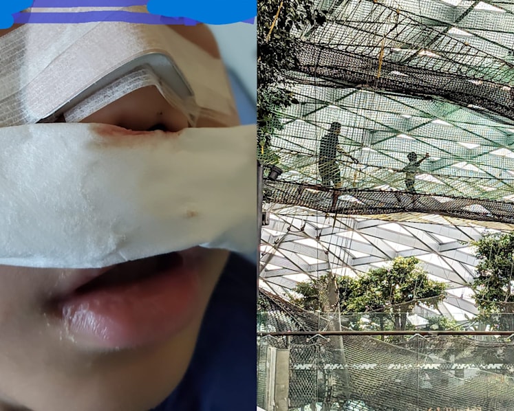 Boy fractures nose at Jewel walking net attraction; BCA and operator urge visitors to follow safety rules and supervise children