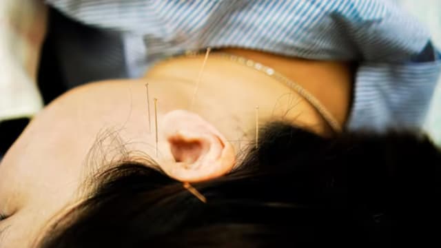 中医师为病人针灸却忘记拔针 被暂停行医三个月
