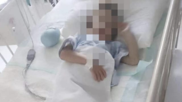 冷水泡脚 热水烫头 中国五岁男童遭母虐待致截肢
