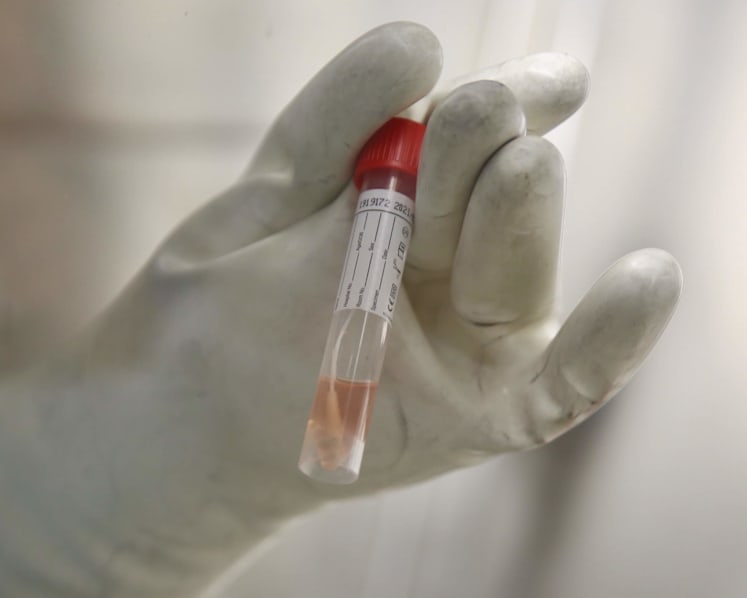 New Covid-19 test kit deployed at all S’pore checkpoints detects its first imported case