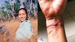 Related article image