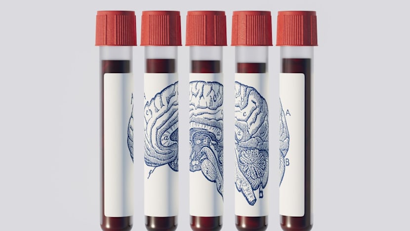 Could a blood test predict if you’ll get Alzheimer’s years before symptoms appear?