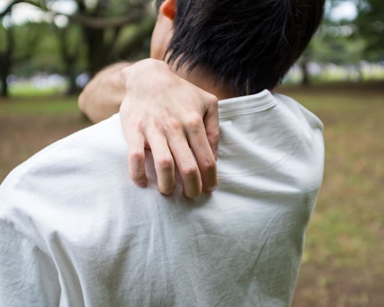 Does your eczema make exercising uncomfortable? How to deal with the heat and sweat to avoid flare-ups