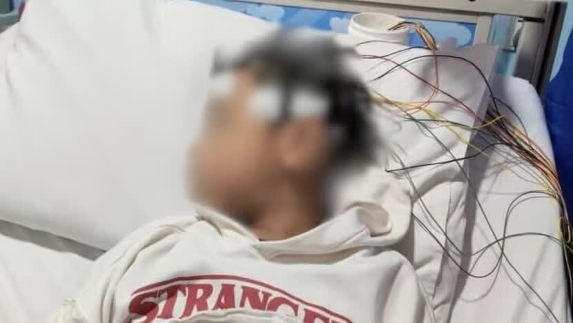 Murid 10 tahun jadi mangsa buli di Johor; Menteri Pendidikan Malaysia ikrar siasatan segera dijalankan