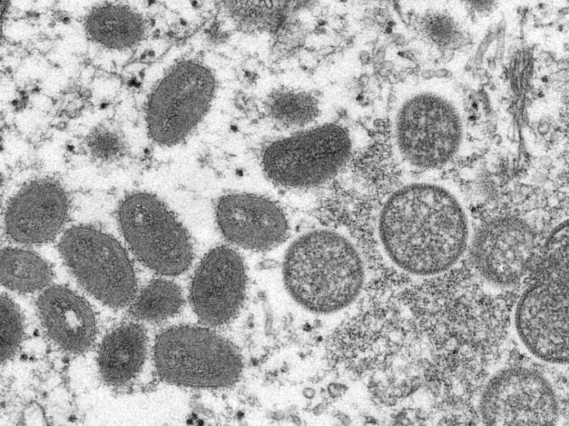 Singapore confirms second local case of monkeypox infection