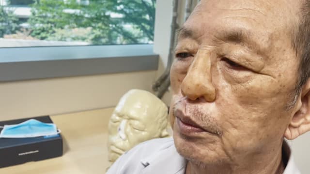 陈笃生3D打印中心为癌症病人打印鼻子假体 帮病人找回自信