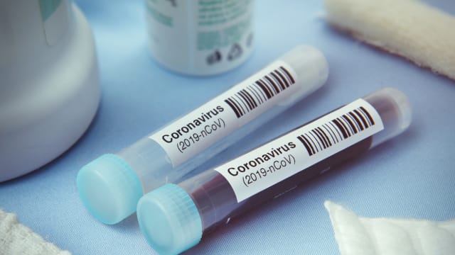 美国：以科学为依据 对中国抵境旅客进行冠病检测