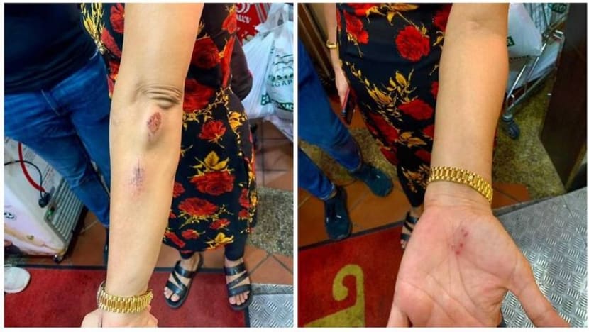 Polis siasat kes lelaki terajang wanita 55 tahun kerana tidak pakai pelitup Polis siasat kes lelaki terajang wanita 55 tahun kerana tidak pakai pelitup