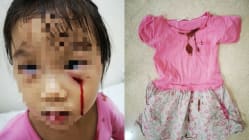 Related article image