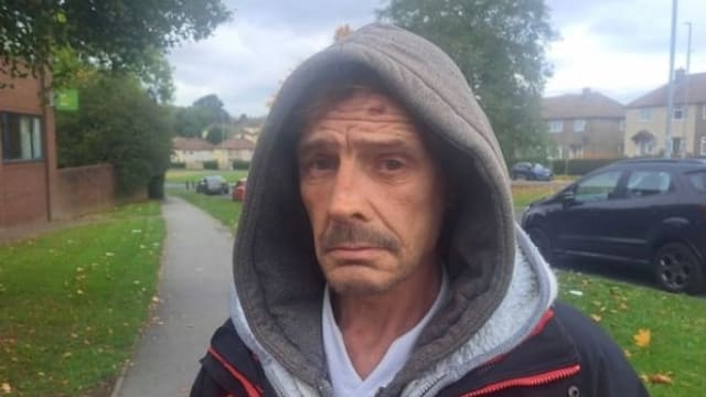 英男子15年来约不到牙医  只靠饮酒和吃药徒手拔牙