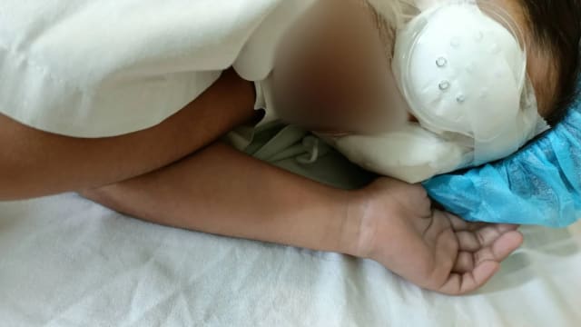 马国十岁女童术后失明 母亲：别怕，妈妈做你的眼睛