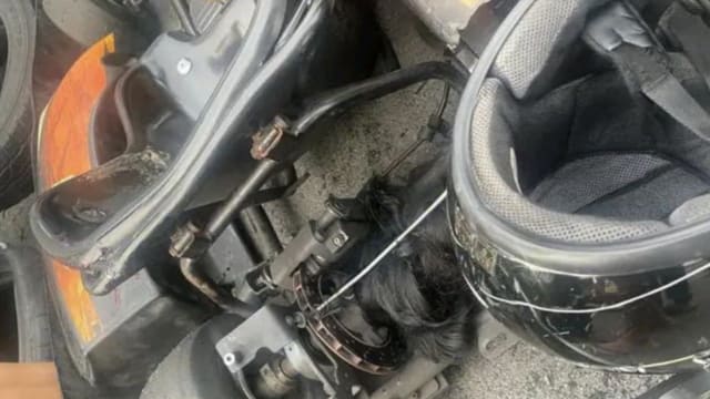 玩卡丁车时头发卡住 南非少女脊椎骨折下半身瘫痪