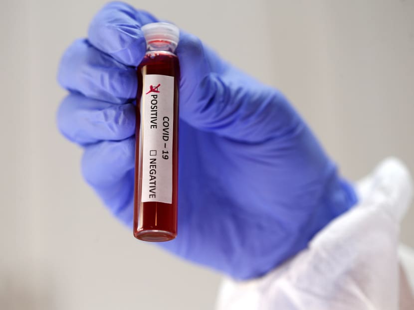 The Ministry of Health said that a laboratory had mislabelled a swab sample from an individual who has Covid-19.