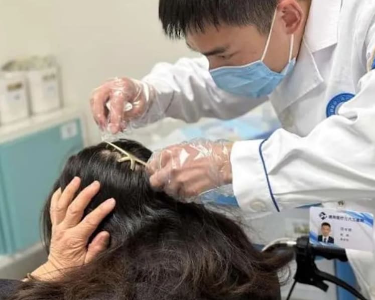 Metal hair claw pierces woman's head after traffic accident in China
