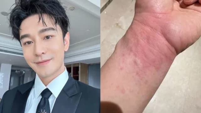 黄晓明深夜晒美食　半小时后被送医院