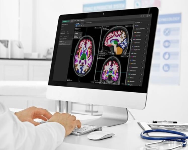 Neurophet Supplies 'Neurophet AQUA' to Raffles Medical in Singapore