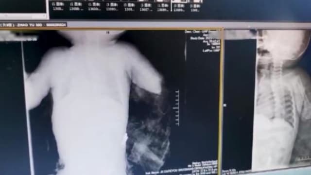 家里养的藏獒突发狂 中国男婴遭咬断手臂