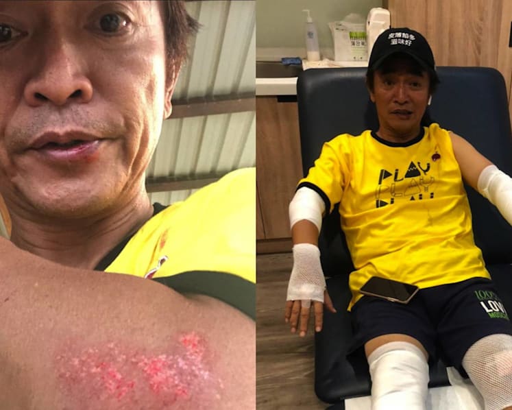 Jacky Wu Crashes Bike While Filming Variety Show; Says His Helmet