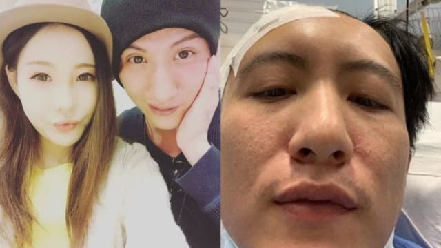 之前家暴前妻、婚内出轨　周永恒反遭现任妻子“打爆头”
