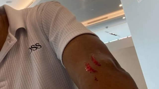 疑不满绕远路 女乘客抓伤私召车司机