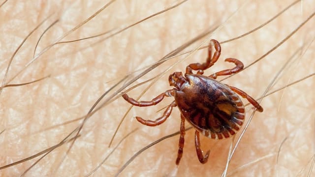感染病毒致眼鼻口流血 巴基斯坦两死亡案例