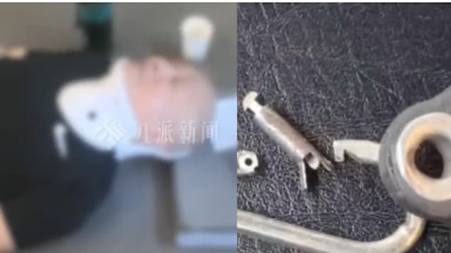 湖南男子健身房健身 “划船机”锁扣断裂被弹飞致双下肢瘫痪