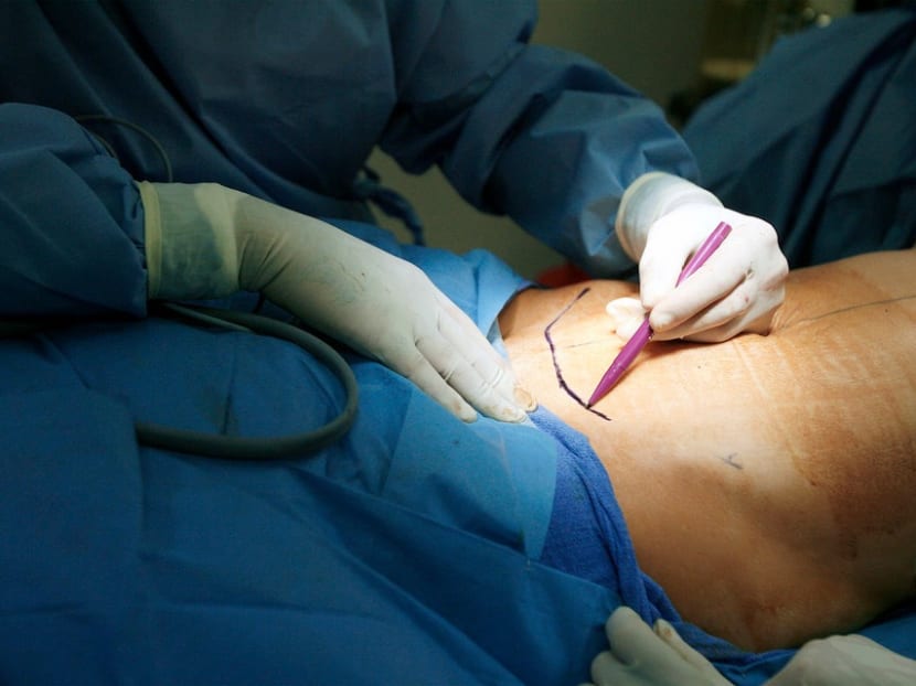 A disciplinary tribunal found that what Tan Kok Leong did to his patient reveals a defect of character, showing he is unfit to be a medical practitioner.